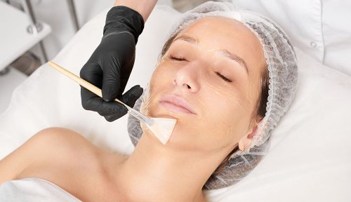 peels promd featured 2